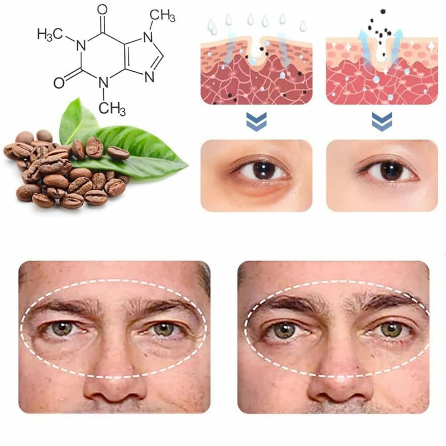Awaken Peptide Depuffing Eye Gel, Firm Peptide Firming Eye Gel, Lifts Firming Anti-Wrinkle Eye Tightener, Educes Dark Circles, Puffiness and Fine Lines (5 Pcs)