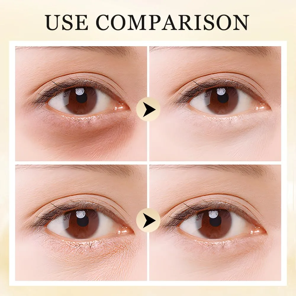 Turmeric Retinol Eye Cream Stick, for Under Eye Bags, Eye Cream Stick for Anti Aging Eye Cream Stick, Reduce Fine Lines (5)